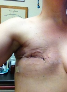 sunken chest (pirate's dream)