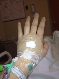 IV's and swollen fingers